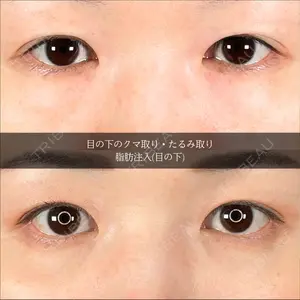アリエル美容クリニック 大宮院 鈴木　桂介医師の症例