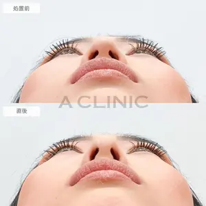A CLINIC（エークリニック） 大阪院 田窪 賢志郎医師の症例