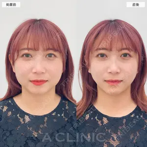 A CLINIC（エークリニック） 大阪院 田窪 賢志郎医師の症例