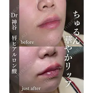 EMMO FACE CLINIC 大阪梅田院 神谷 一成医師の症例