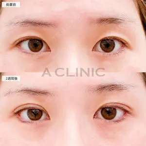 A CLINIC（エークリニック） 大阪院 田窪 賢志郎医師の症例