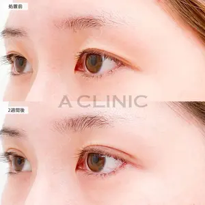 A CLINIC（エークリニック） 大阪院 田窪 賢志郎医師の症例