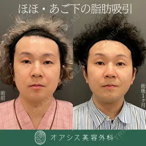 オアシス美容外科 遠藤 剛史医師の症例