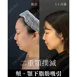 HAAB×DREAM BEAUTY CLINIC 東京本院 吉岡 修一医師の症例