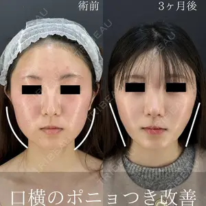 HAAB×DREAM BEAUTY CLINIC 東京本院 吉岡 修一医師の症例