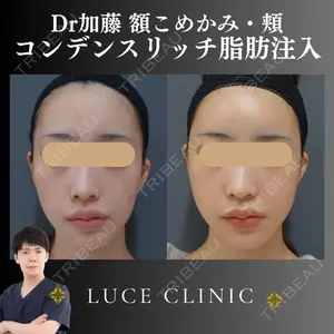 ルーチェクリニック 銀座院 加藤晴之輔医師の症例