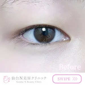 仙台N美容クリニック 小阪 捺稀医師の症例