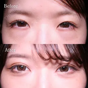 HAAB BEAUTY CLINIC 名古屋院 丸山 舜大医師の症例