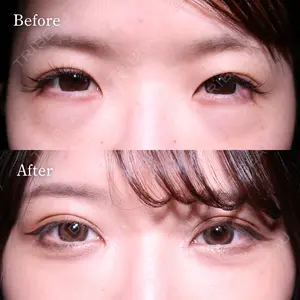HAAB BEAUTY CLINIC 名古屋院 丸山 舜大医師の症例