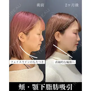 HAAB×DREAM BEAUTY CLINIC 東京本院 吉岡 修一医師の症例