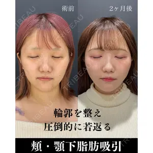 HAAB×DREAM BEAUTY CLINIC 東京本院 吉岡 修一医師の症例