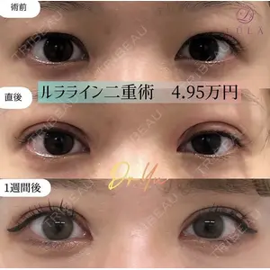 ルラ美容クリニック 札幌本院の症例