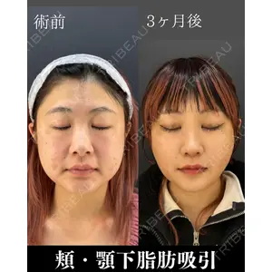 HAAB×DREAM BEAUTY CLINIC 東京本院 吉岡 修一医師の症例