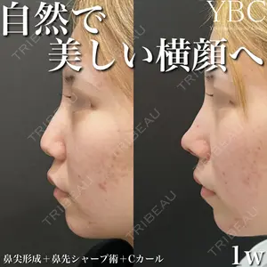 YBC横浜美容外科 大宮院 磯村 亮輔医師の症例