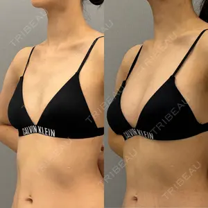 ARIEL.BUST.CLINIC 石塚 紀行医師の症例