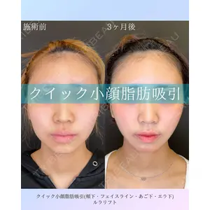 ルラ美容クリニック 札幌院 佐藤 雄紀医師の症例