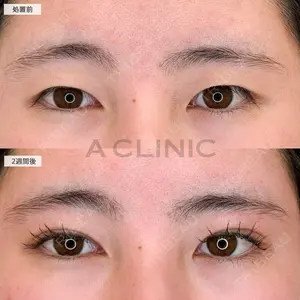 A CLINIC（エークリニック） 大阪院 田窪 賢志郎医師の症例