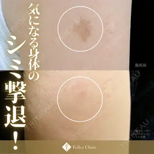Fellez Clinic【フェルズクリニック】の症例