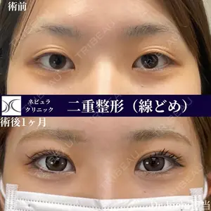 ネビュラクリニック 京都院 岸 大輔医師の症例
