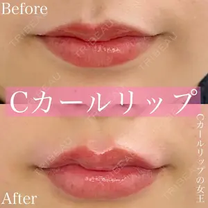 ルラ美容クリニック 渋谷本院 昼間 路子医師の症例