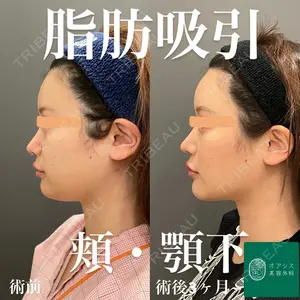 オアシス美容外科 遠藤 剛史医師の症例