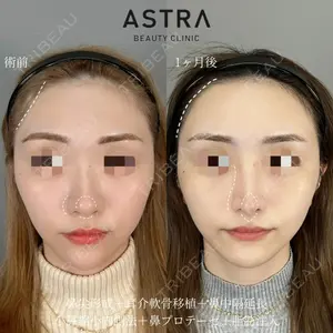 ASTRA BEAUTY CLINIC 塩満 惠子医師の症例