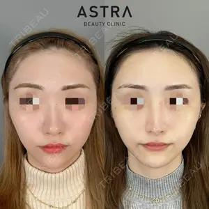 ASTRA BEAUTY CLINIC 塩満 惠子医師の症例
