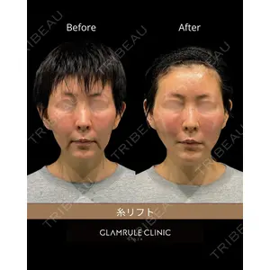 GLAMRULE CLINIC (グラムルール クリニック) 銀座院の症例