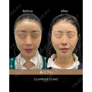 GLAMRULE CLINIC (グラムルール クリニック) 銀座院の症例