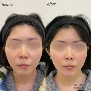 DMTC美容皮膚科 日本橋院 松井泉医師の症例