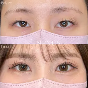 NEXUS CLINIC 横田 智子医師の症例