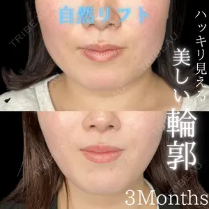 THE FIRST CLINIC 多摩センター院 惟村 公郁医師の症例