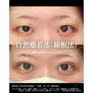 シンデレラ＆ダヴィンチクリニック 宮田 洋佑医師の症例