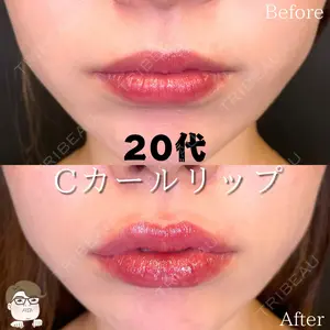 ルラ美容クリニック 札幌院 佐藤 雄紀医師の症例