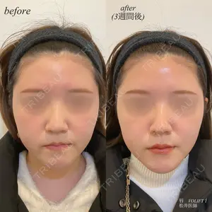 DMTC美容皮膚科 日本橋院 松井泉医師の症例