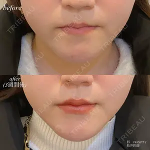 DMTC美容皮膚科 日本橋院 松井泉医師の症例