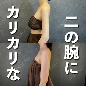 AVAN TOKYO 銀座脂肪吸引 クリニック 森脇 進医師の症例