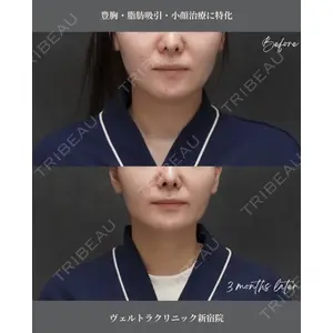 ヴェルトラクリニック 大阪院の症例