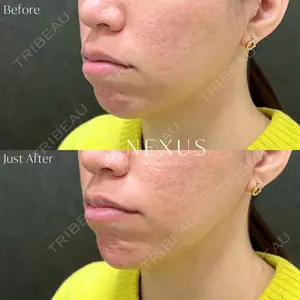 NEXUS CLINIC 岩井 勝矢医師の症例