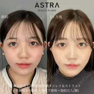 ASTRA BEAUTY CLINIC 塩満 惠子医師の症例