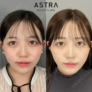 ASTRA BEAUTY CLINIC 塩満 惠子医師の症例