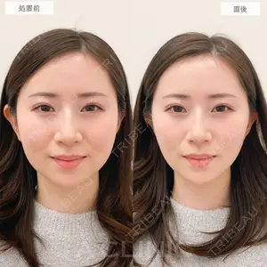 A CLINIC（エークリニック） 横浜院 柴田 貴志医師の症例