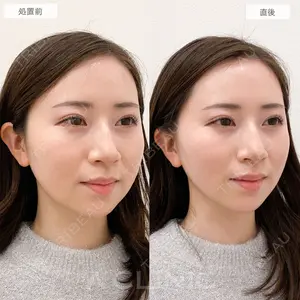 A CLINIC（エークリニック） 横浜院の症例