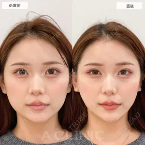 A CLINIC（エークリニック） 仙台院 伊藤 瑠桂医師の症例