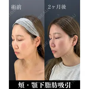 HAAB×DREAM BEAUTY CLINIC 東京本院 吉岡 修一医師の症例