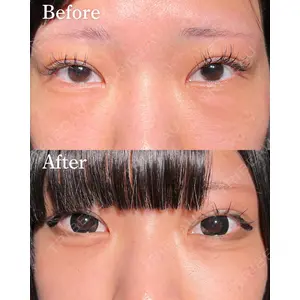 HAAB BEAUTY CLINIC 名古屋院 丸山 舜大医師の症例