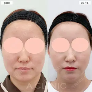 A CLINIC（エークリニック） 名古屋院 住田 篤紀医師の症例