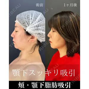 HAAB×DREAM BEAUTY CLINIC 東京本院 吉岡 修一医師の症例