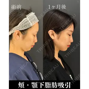 HAAB×DREAM BEAUTY CLINIC 東京本院 吉岡 修一医師の症例