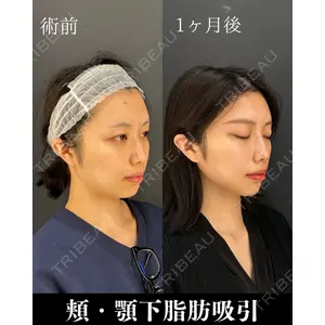HAAB×DREAM BEAUTY CLINIC 東京本院 吉岡 修一医師の症例